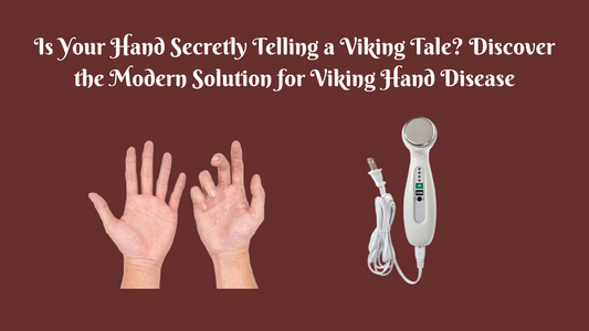Is Your Hand Secretly Telling a Viking Tale? Discover the Modern Solution for Viking Hand Disease