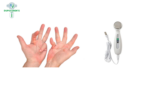 Revolutionizing Dupuytren’s Contracture: Non-Surgical Hand Treatment with Dupuytren’s Wand