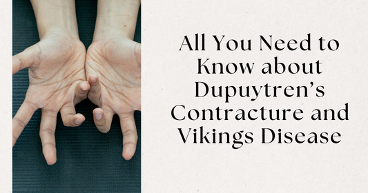 All You Need to Know about Dupuytren’s Contracture and Vikings Disease