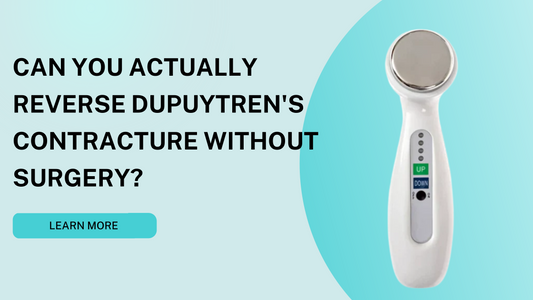 Can You Actually Reverse Dupuytren's Contracture Without Surgery?