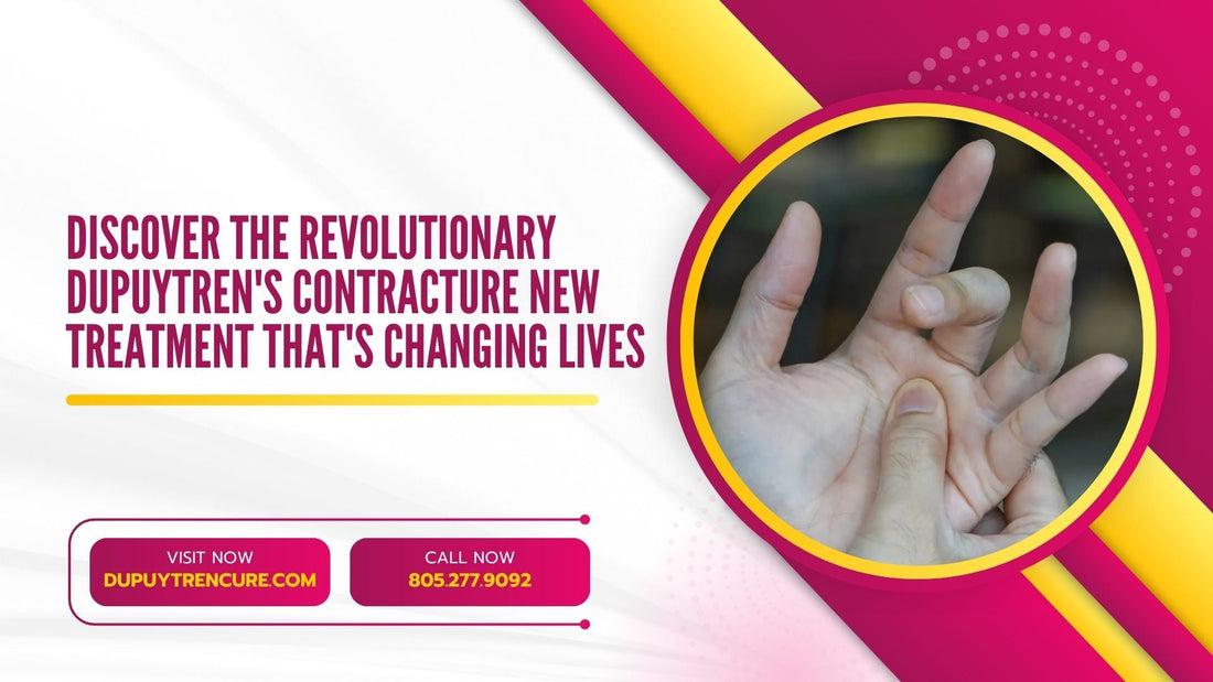 Discover the Revolutionary Dupuytren's Contracture New Treatment That's Changing Lives