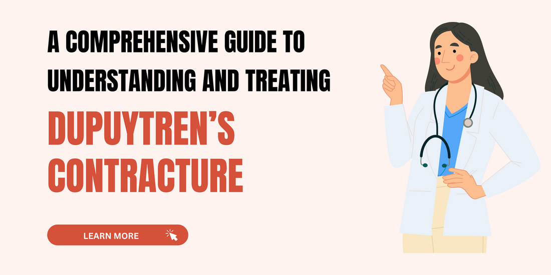 A Comprehensive Guide to Understanding and Treating "Dupuytren’s Contracture"