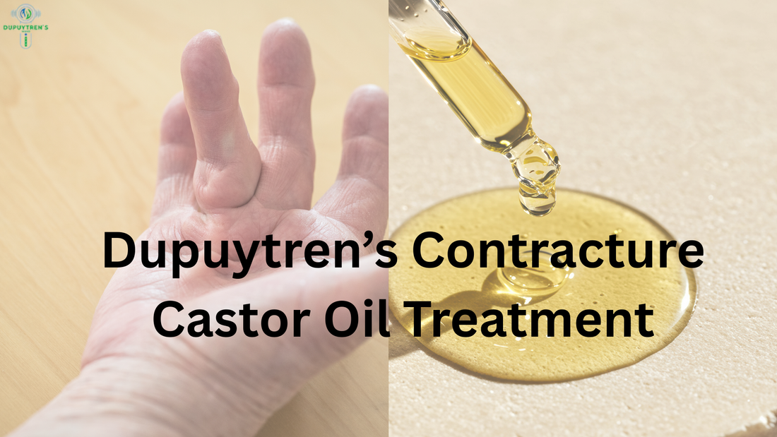 Dupuytren's Contracture Castor Oil Treatment: Breaking Free from Viking Hand Disease with Natural Solutions