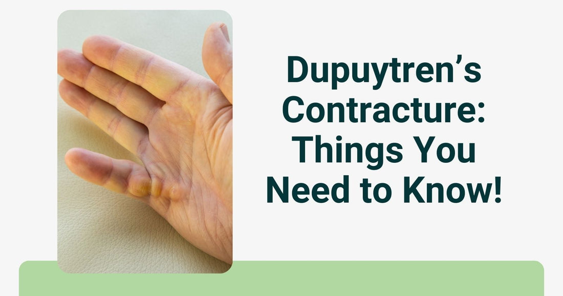 Dupuytren’s Contracture: Things You Need to Know!