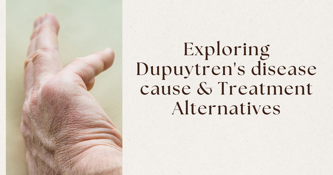 Exploring Dupuytren’s disease cause & Treatment Alternatives