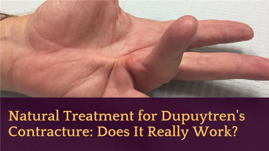 Natural Treatment for Dupuytren's Contracture