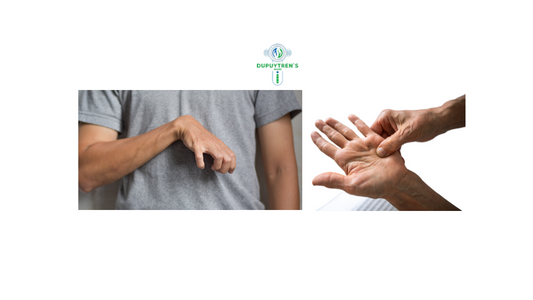 Why Does Dupuytren’s Contracture Hurt?