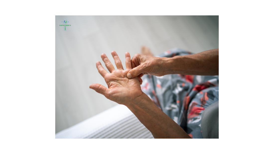Why Don’t Any Home Remedies For Dupuytren’s Disease Seem To Work?