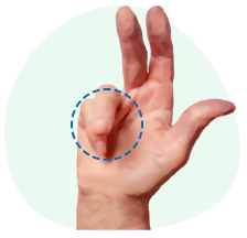 Trigger Finger
